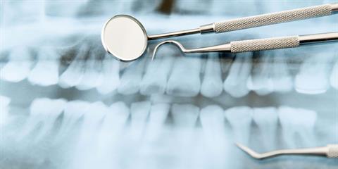 What You Need to Know About Dental X-Rays Photo