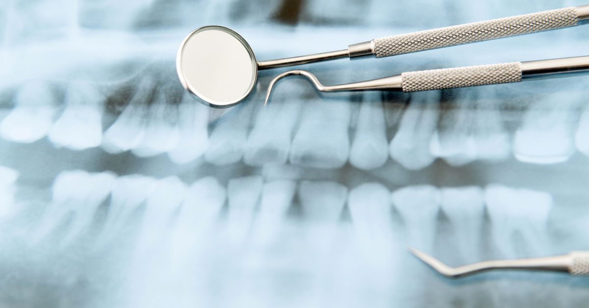 Photo of dental tools lying on a dental x-ray.