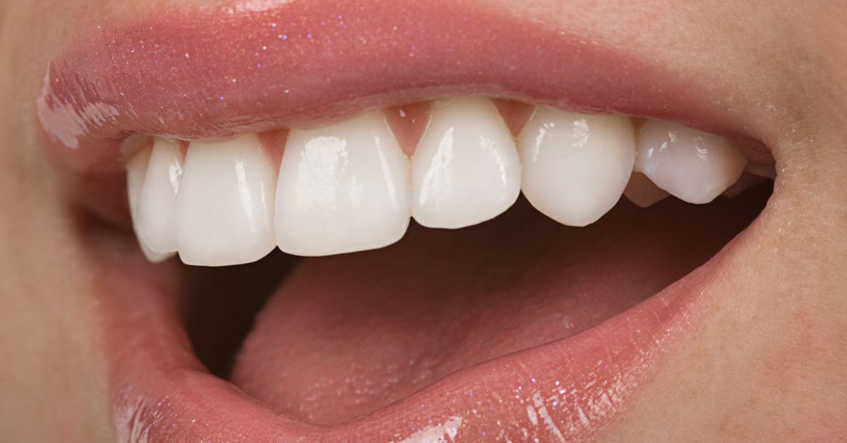 Close up of woman smiling.